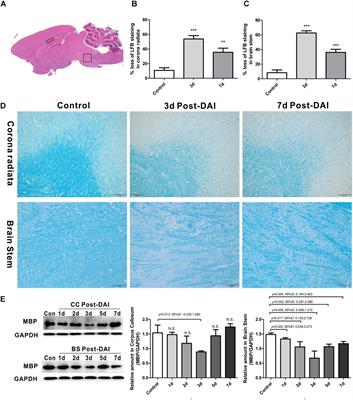 Myelin Damage in Diffuse Axonal Injury